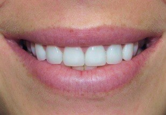 Patient's smile after dental treatment