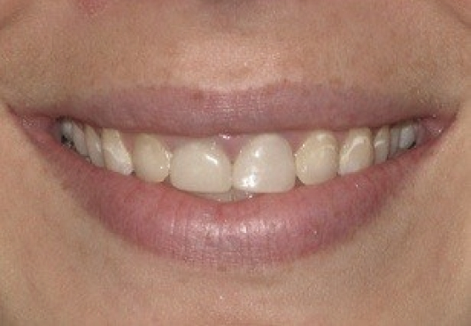 Patient's smile before dental treatment