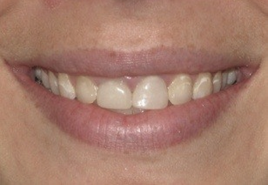 Patient's smile before dental treatment